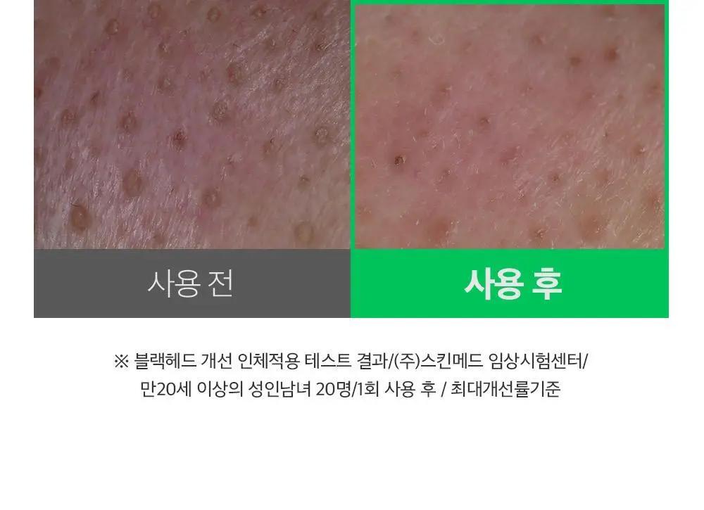 [말끔모공/블랙헤드] 성분에디터 그린토마토 모공 클렌징 오일 200ml 상세페이지 14